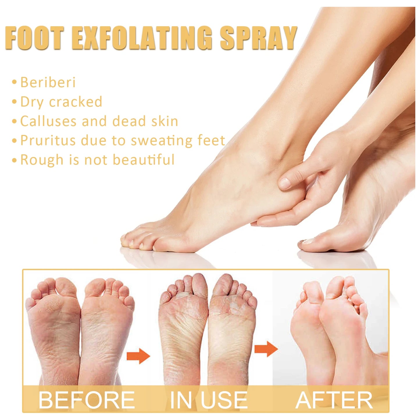 Eelhoe Foot Exfoliating Spray Moisturizes Skin, Removes Dead Skin