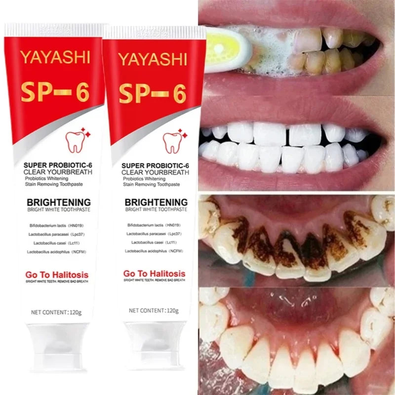 Teeth Whitener Oral Hygiene