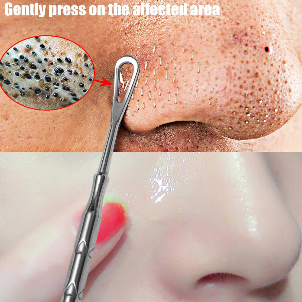 Acne Needle Face Blemish Extractor