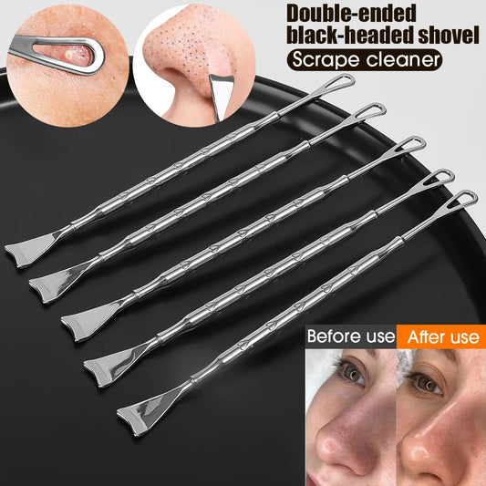 Acne Needle Removing Treatment