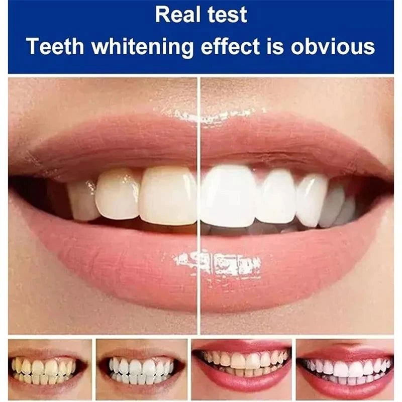 Probiotic Whitening Toothpaste