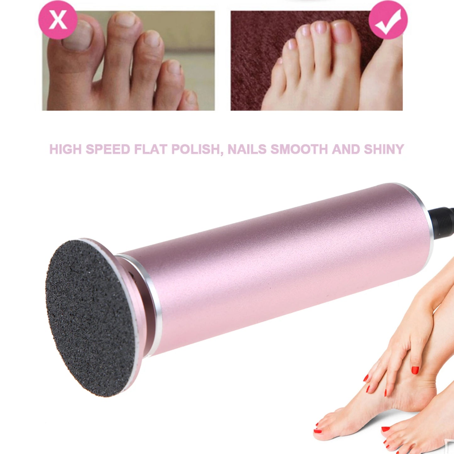 Electric Foot File Callus Remover